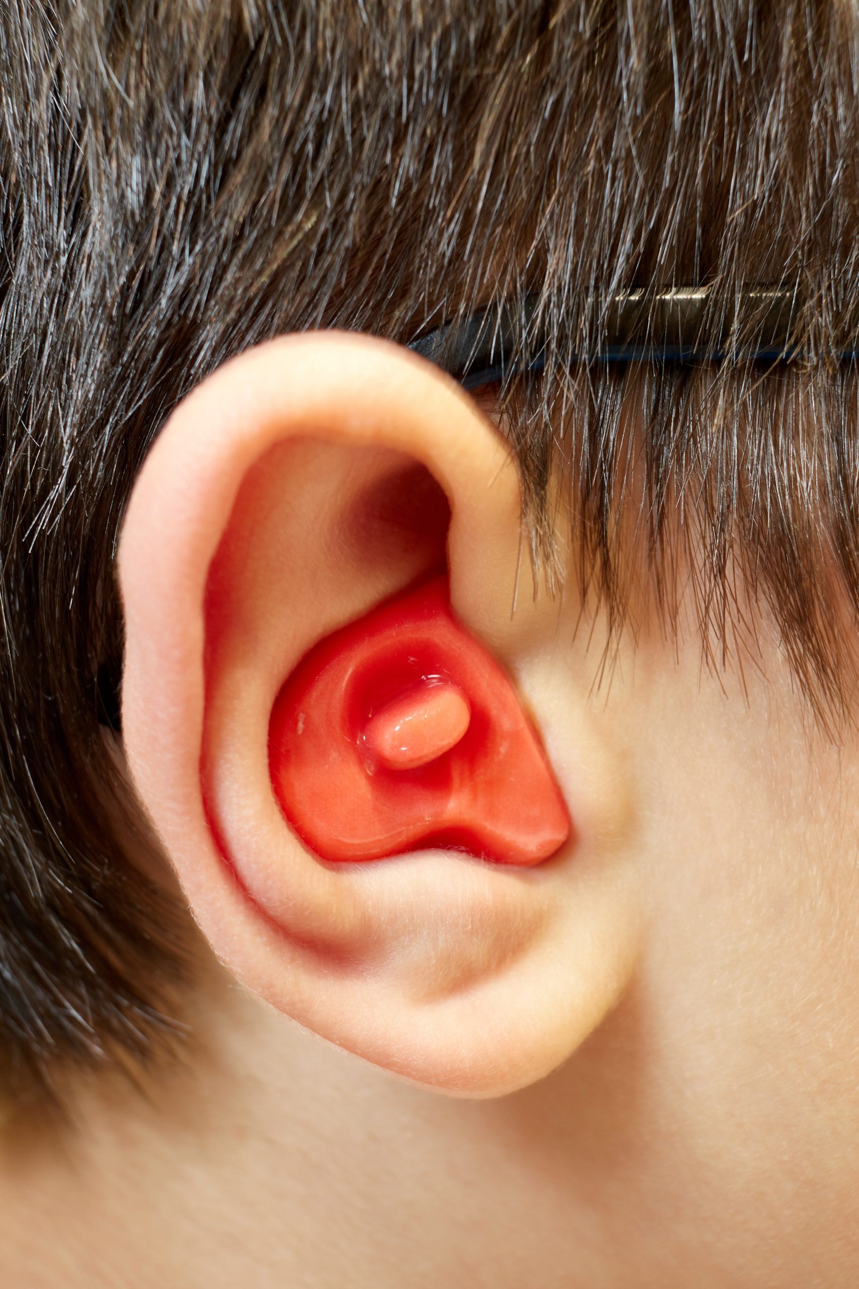 Can a hearing clinic make me custom ear molds?